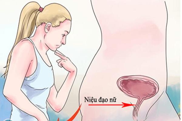 Một số triệu chứng viêm niệu đạo nữ không nên bỏ qua