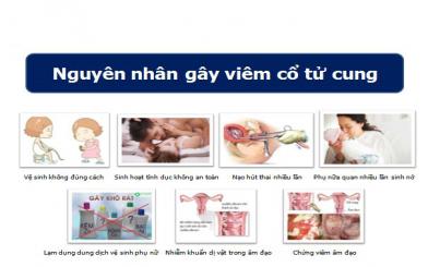 Nguyên nhân gây viêm nhiễm cổ tử cung bạn cần biết