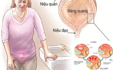 Bệnh viêm niệu đạo có nguy hiểm không?