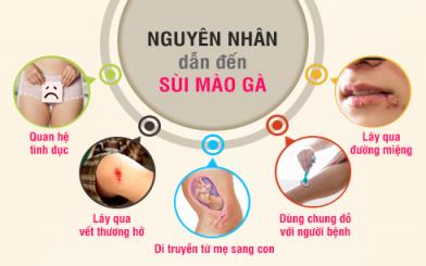 Nguy&ecirc;n nh&acirc;n g&acirc;y bệnh s&ugrave;i m&agrave;o g&agrave; ở nữ giới