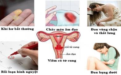 Triệu chứng viêm cổ tử cung không thể bỏ qua