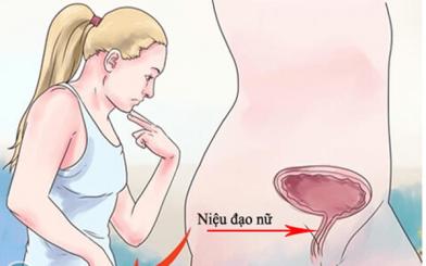 Một số triệu chứng viêm niệu đạo nữ không nên bỏ qua