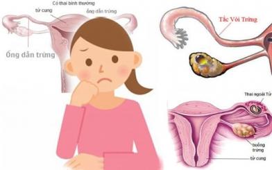 Tắc vòi trứng có chữa được không?