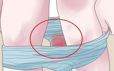 L&agrave;m sạch tử cung bao nhi&ecirc;u tiền?