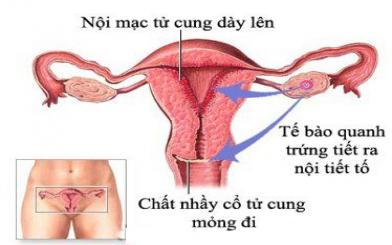Một số triệu chứng tăng sinh vi&ecirc;m ni&ecirc;m mạc tử cung