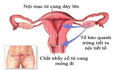 Nguy hại của bệnh tăng sinh viêm niêm mạc tử cung