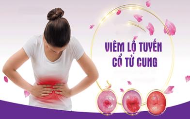 4 tri&ecirc;̣u chứng vi&ecirc;m l&ocirc;̣ tuy&ecirc;́n c&ocirc;̉ tử cung -  C&acirc;̀n khám ngay 