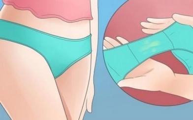 Nấm vùng kín - Phương pháp điều trị hiệu quả, triệt để