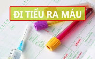 Tiểu ra máu: Dấu hiệu của bệnh gì?
