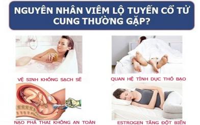 5 nguy&ecirc;n nh&acirc;n vi&ecirc;m lộ tuyến cấp độ 1 kh&ocirc;ng phải ai cũng biết