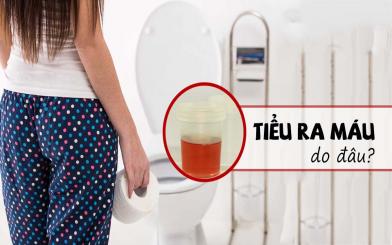 TIỂU RA MÁU – DẤU HIỆU BỆNH PHỤ KHOA NGUY HIỂM MÀ CHỊ EM ÍT BIẾT