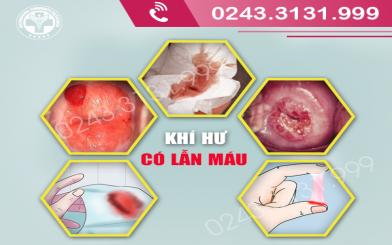 Khí hư lẫn máu cảnh báo dấu hiệu bệnh lý nguy hiểm