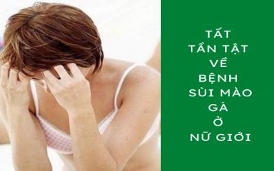 Tất tần tật về bệnh s&ugrave;i m&agrave;o g&agrave; ở nữ giới 