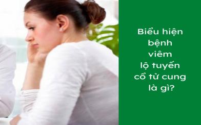 Biểu hiện bệnh viêm lộ tuyến cổ tử cung là gì?