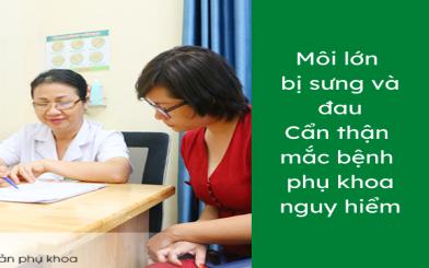 M&ocirc;i lớn bị sưng v&agrave; đau - Cẩn thận mắc bệnh phụ khoa nguy hiểm