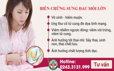 [Bật mí] Phương pháp điều trị viêm lộ tuyến tốt và an toàn?