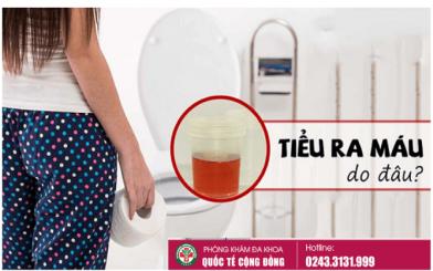 Tiểu ra máu ở nữ cảnh báo ung thư đường tiết niệu rất cao
