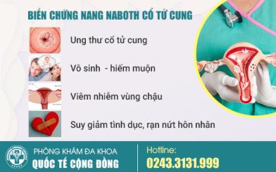Chia sẻ cách điều trị nang naboth cổ tử cung hiệu quả, tiết kiệm