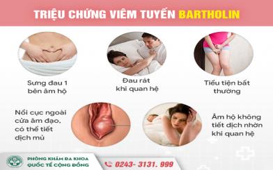 Hết sức cẩn trọng với viêm tuyến bartholin sưng to, vỡ mủ!