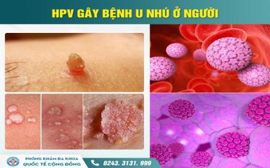 H&igrave;nh ảnh s&ugrave;i m&agrave;o g&agrave; nữ chi tiết - Cảnh b&aacute;o dấu hiệu bệnh x&atilde; hội nguy hiểm 