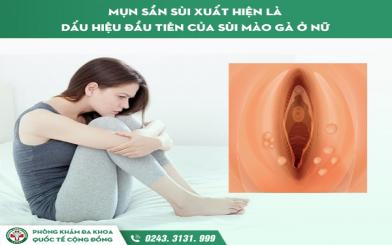 Dấu hiệu s&ugrave;i m&agrave;o g&agrave; nữ - C&aacute;ch ph&aacute;t hiện sớm nhất