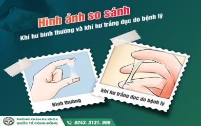 Kh&iacute; hư m&agrave;u trắng đục cẩn thận dấu hiệu bệnh phụ khoa!