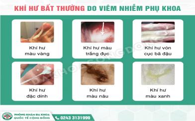 Nguyên nhân khiến khí hư đặc sệt màu trắng chị em cần biết