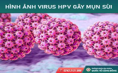 Cùng bác sĩ chuyên khoa kiểm chứng 3 hiểu lầm về virus HPV