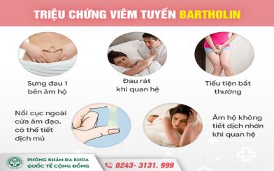 Viêm tuyến Bartholin chữa ngay kẻo hối không kịp!!!
